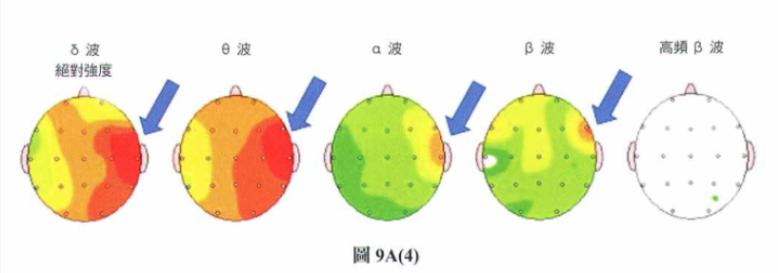 图9A(3)